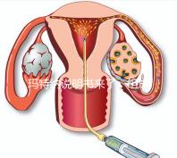 瑪特納說明書來了，組成成分、生產國家這都有
