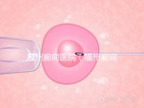 福州癲癇醫(yī)院(福州癲癇醫(yī)院在哪里)