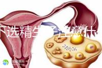私下選精生子注意什么細節(jié)要早知,選擇正規(guī)機構最重要