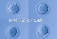 精子向前運動PR14是否正常聽專家怎么說，當心弱精找上門
