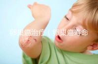 卵巢癌治療(卵巢癌壽命一覽表)