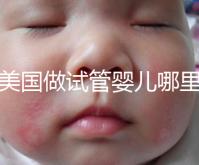 去美國做試管嬰兒哪里最好,4家好評輔助生殖機構(gòu)推薦