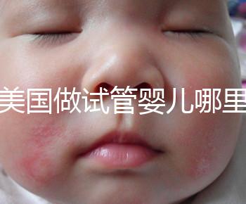 去美國做試管嬰兒哪里最好，4家好評輔助生殖機(jī)構(gòu)推薦