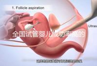 全國試管嬰兒成功率高的醫院排名，內附2023試管費用及成功率參考