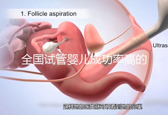 全國試管嬰兒成功率高的醫(yī)院排名,內(nèi)附2023試管費(fèi)用及成功率參考