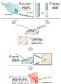 做試管嬰兒最好的醫(yī)院是哪一家?