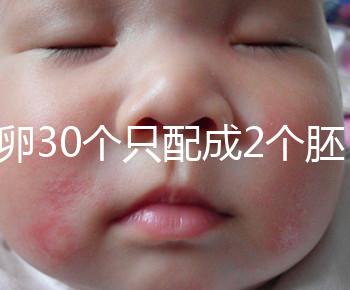 取卵30個(gè)只配成2個(gè)胚胎別放棄！卵巢傷口小移植成功率不低