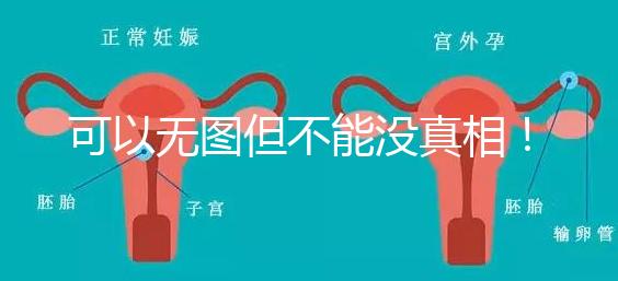 可以無圖但不能沒真相！段濤大夫帶你了解B超檢查報告單