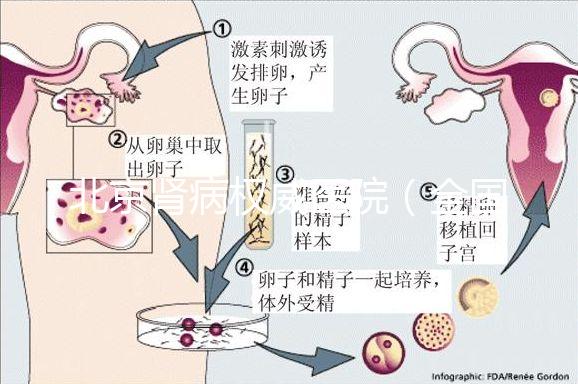 北京腎病權威醫院(全國腎病醫院排名一)