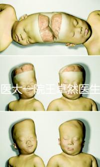 哈醫(yī)大一院王卓然醫(yī)生試管攻略,坐診時(shí)間、成功率早知道