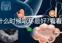 什么時候取環(huán)最好?看看各地姐妹們有什么經驗之談