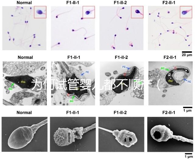 為何試管嬰兒都不順產(chǎn)(為何試管嬰兒都不順產(chǎn)呢)