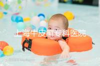 上海牛皮癬?？漆t院