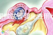 中國做試管嬰兒費用收費價目表一覽,包含具體成本預(yù)算