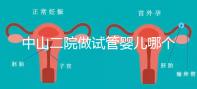 中山二院做試管嬰兒哪個醫生好？附醫院試管成功率