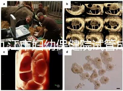 九江市婦幼保健院試管成功率高、費用低？生殖醫生揭開真相