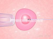 懷孕期間做哪些運(yùn)動(dòng)有助于自然分娩?