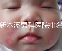 更新本溪男科醫(yī)院排名，不要錯過本溪湖區(qū)top3醫(yī)生的專業(yè)