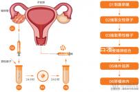 無(wú)性婚姻做試管嬰兒后來(lái)怎么樣?三個(gè)大案例揭開(kāi)了內(nèi)幕