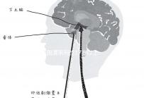 泰國清萊同性17歲以上便能結(jié)婚，在國內(nèi)承不承認(rèn)進(jìn)來看