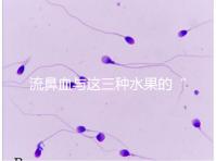 流鼻血與這三種水果的“奇妙”關(guān)系,建議少吃,多補(bǔ)充維生素K可以幫助止血!