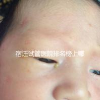 宿遷試管醫(yī)院排名榜上哪家好,不造助孕成功率和費用別亂選