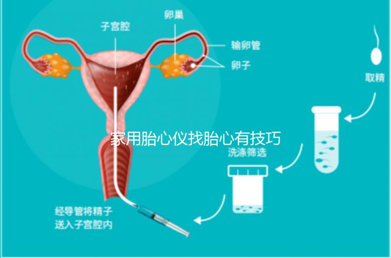 家用胎心儀找胎心有技巧，飯后半個(gè)小時(shí)測(cè)準(zhǔn)確率稍高