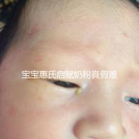 寶寶惠氏啟賦奶粉真假難斷,5招教你快速辨別