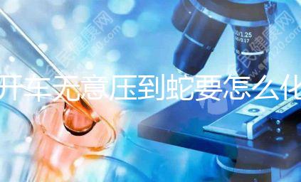 開車無(wú)意壓到蛇要怎么化解進(jìn)來(lái)瞧,要不要報(bào)警一目了然