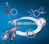廣州生殖科醫(yī)院排名前十，中山六院不止一家
