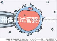 廣州供卵試管嬰兒醫(yī)院匯總,真實案例告訴你廣東哪家最好