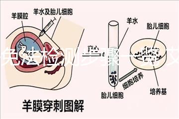 酶免法檢測步驟一覽 艾滋病