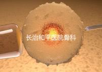 長(zhǎng)治和平醫(yī)院骨科