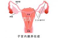 防止暈厥方法（防止暈厥方法有哪些）