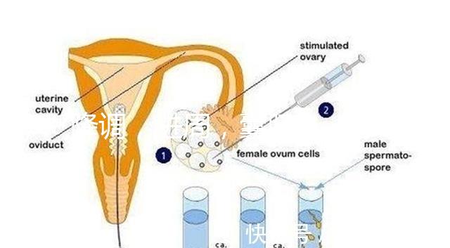 降調，進周，囊胚……這些試管嬰兒助孕術語你都懂嗎？