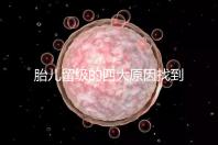 胎兒留級的四大原因找到了！多半和媽媽太懶不運動有關系