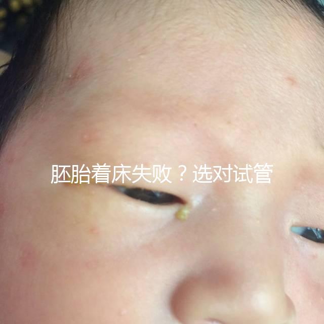 胚胎著床失敗?選對試管嬰兒醫生很重要