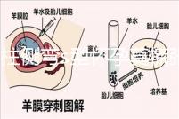脊柱側彎s型懷孕莫慌張，能否順產還得看這4大要素