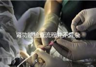 腎功能檢查流程并不復(fù)雜，掌握這幾個步驟方可一步到位