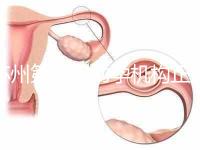 蘇州第三代助孕機構正規可靠嗎？實地考察才為真