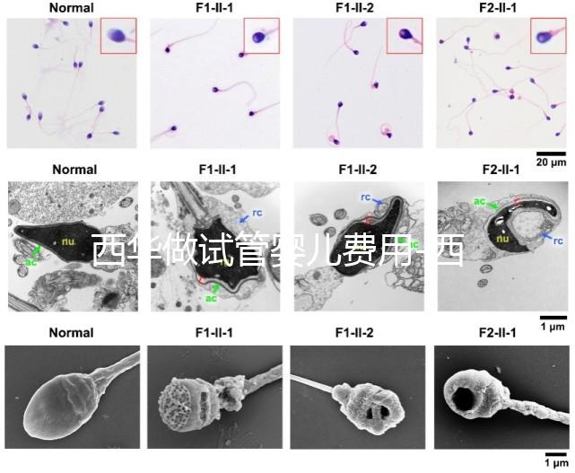 西華做試管嬰兒費用-西華醫(yī)院試管嬰兒花費明細(xì)表