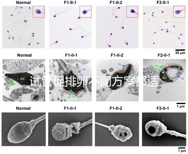 試管促排卵不同方案都適合哪些人？如何監(jiān)測排卵？