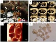 試管嬰兒流(試管嬰兒流程步驟與時(shí)間)