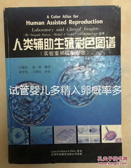 試管嬰兒多精入卵概率多少難說,比正常配對低別瞎操心