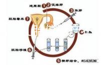 試管嬰兒胎停流產(chǎn)不全是女人的鍋,精子質(zhì)量的影響不容忽視
