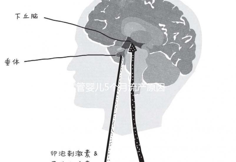 試管嬰兒5個月流產原因有三，多久能再次移植需慎重考慮