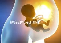 解讀2種torch檢查方法:PCR檢測可減少血清學假陽性診斷