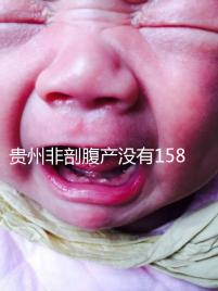 貴州非剖腹產(chǎn)沒(méi)有158天的產(chǎn)假，2024年新規(guī)定告訴你多少天