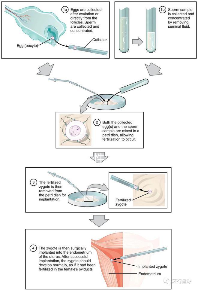貴陽單身女性禁止凍卵？持“三證”已婚女性就能凍卵