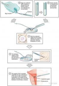 貴陽(yáng)未婚子女戶(hù)口如何向婦女介紹,附2024年結(jié)算流程